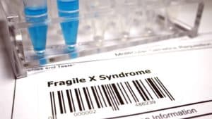 תסמונת ה-X השביר