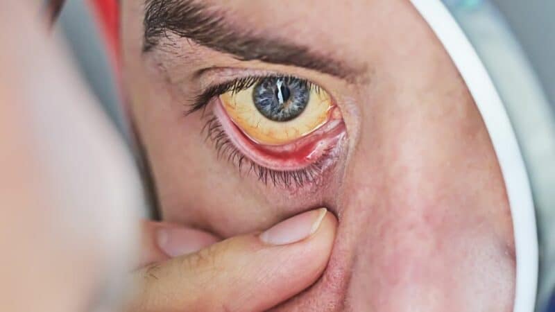 ניתן לאבחן מחלות