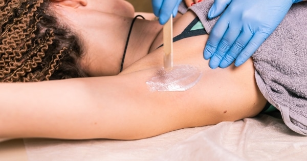 הסרת שיער בלייזר