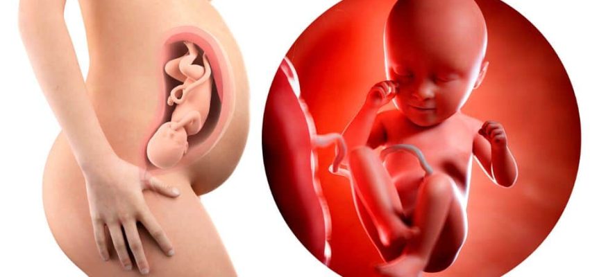 גוף טרום לידתי