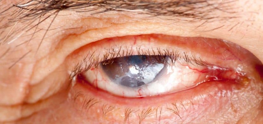 ניתן לאבחן מחלות